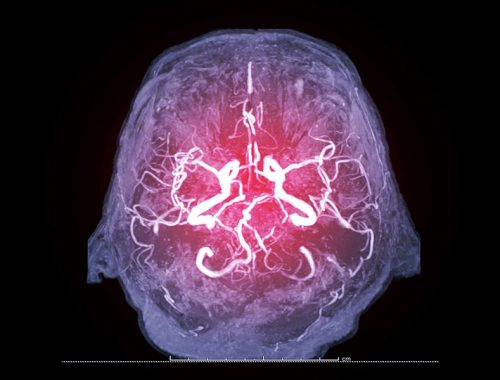 graphic of brain