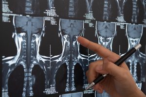 x-ray of a patient getting ready to have cranial base & brain surgery