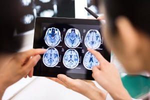 two neurosurgeons from brain and spine surgeons of new york looking at an MRI of a patient getting ready to undergo functional neurosurgery