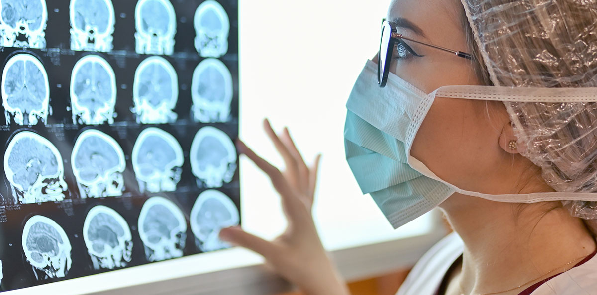 doctor looking at brain tumors