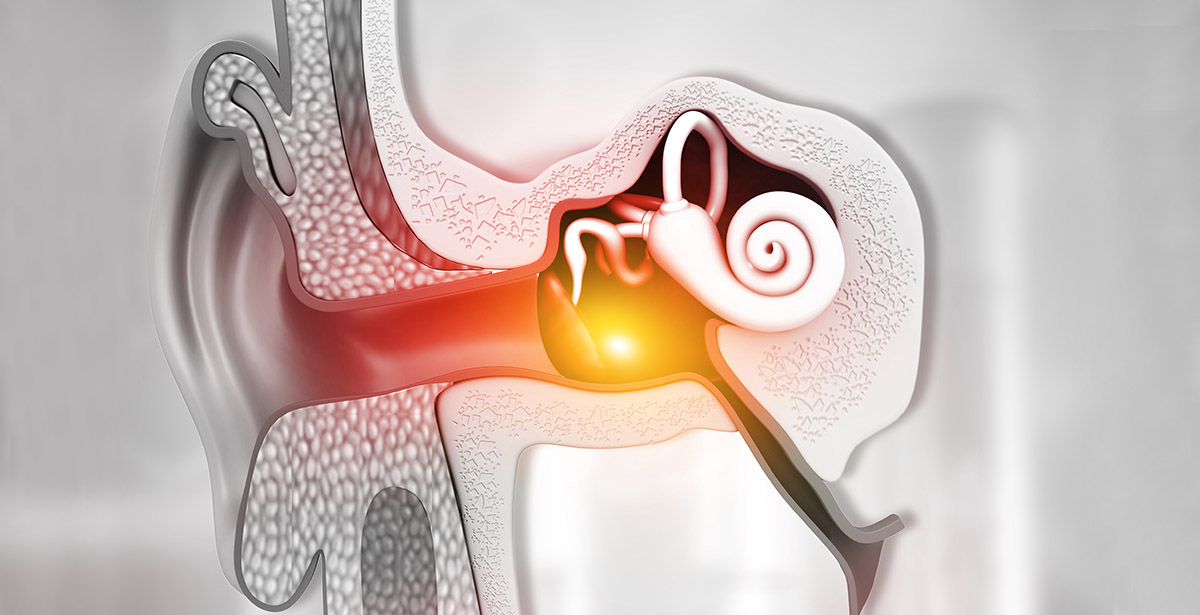 illustration of the middle ear to illustrate Cholesteatoma