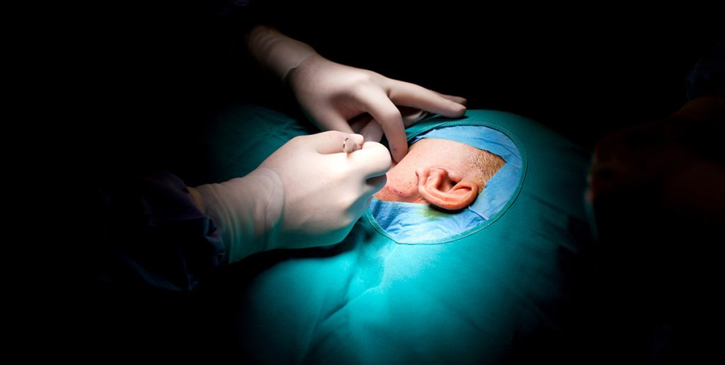 Stapedectomy Surgery Brain & Spine Surgeons of New York