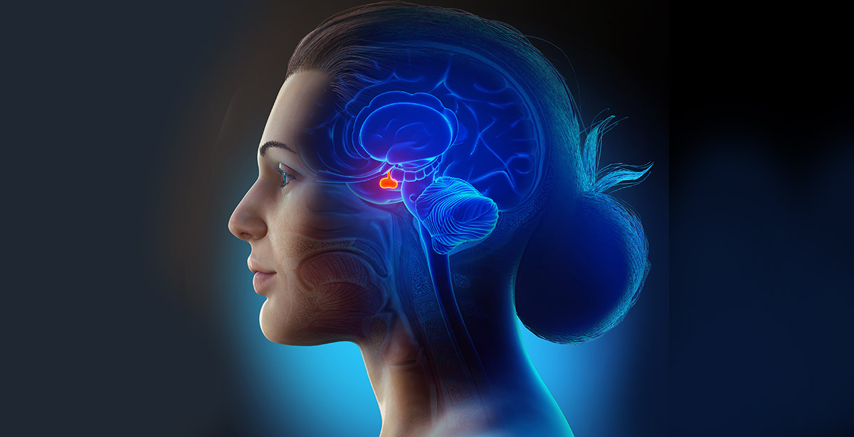 3D illustration of pituitary gland tumors