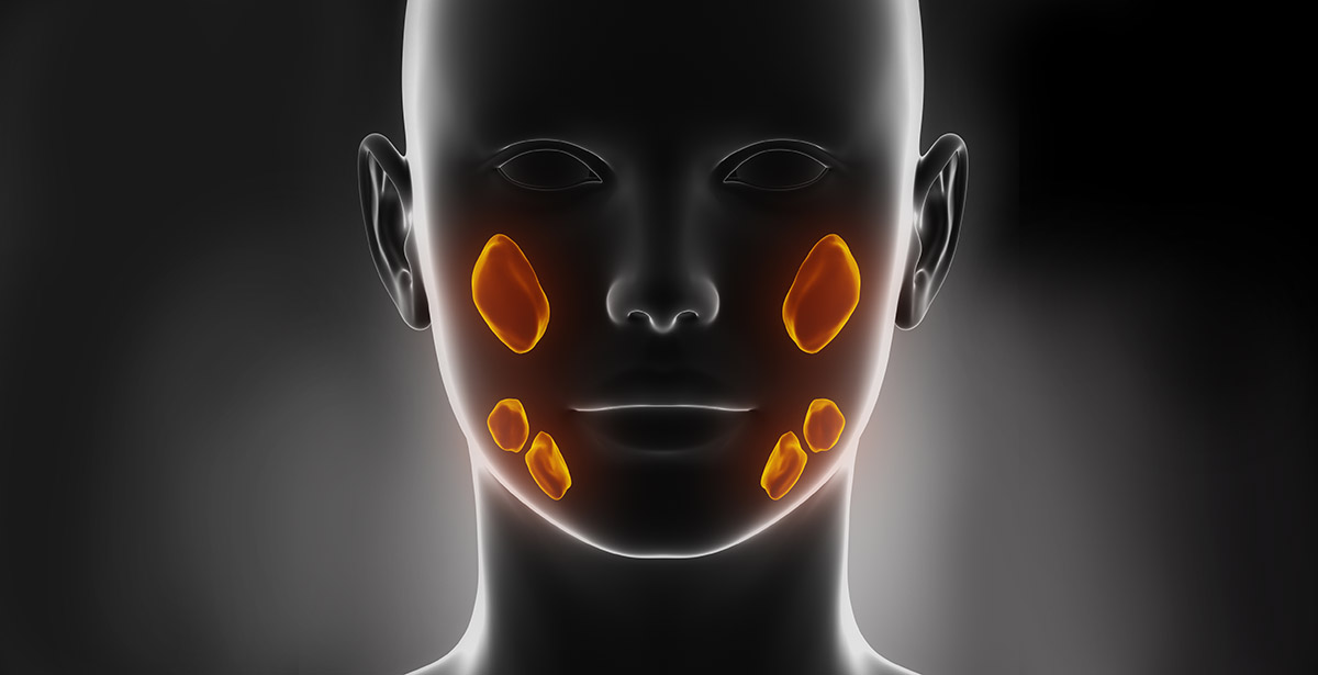 3D illustration of salivary gland tumors