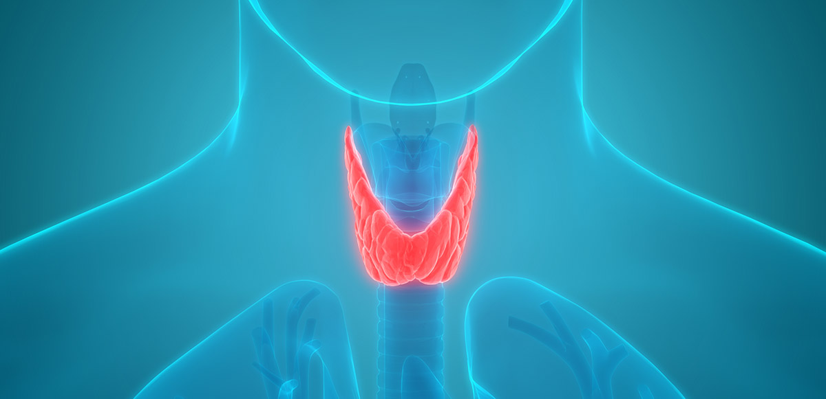 3D illustration of thyroid gland tumors