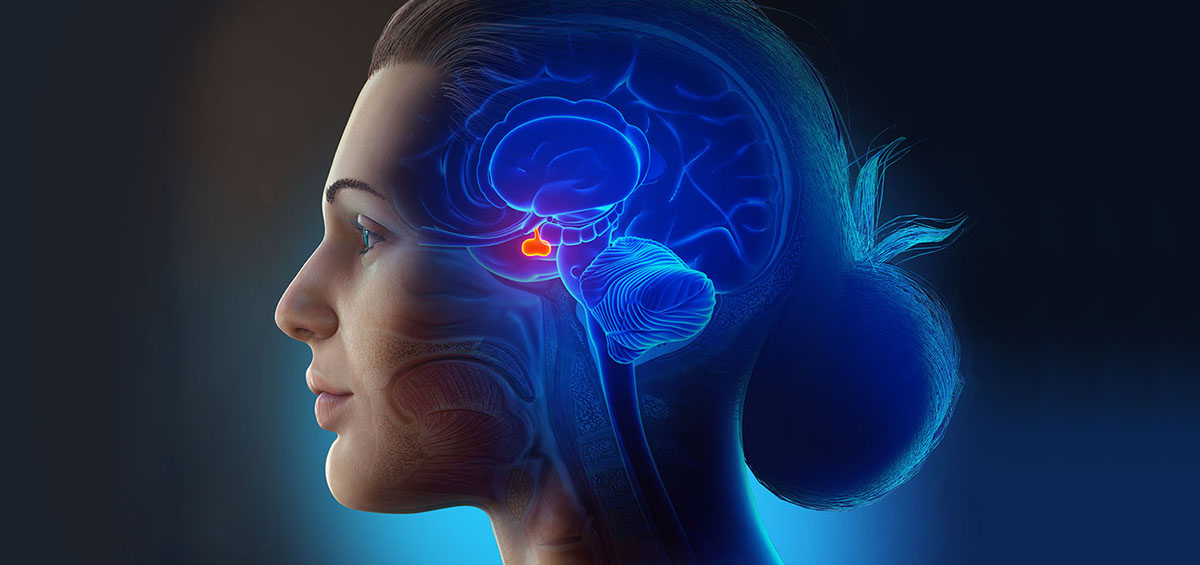 3d illustration of Craniopharyngioma