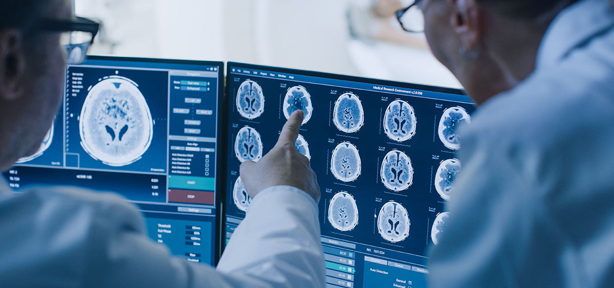 Oligodendroglioma