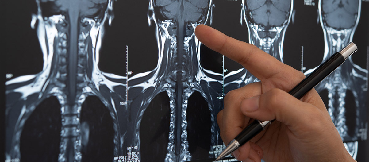 Cranial Base & brain tumors