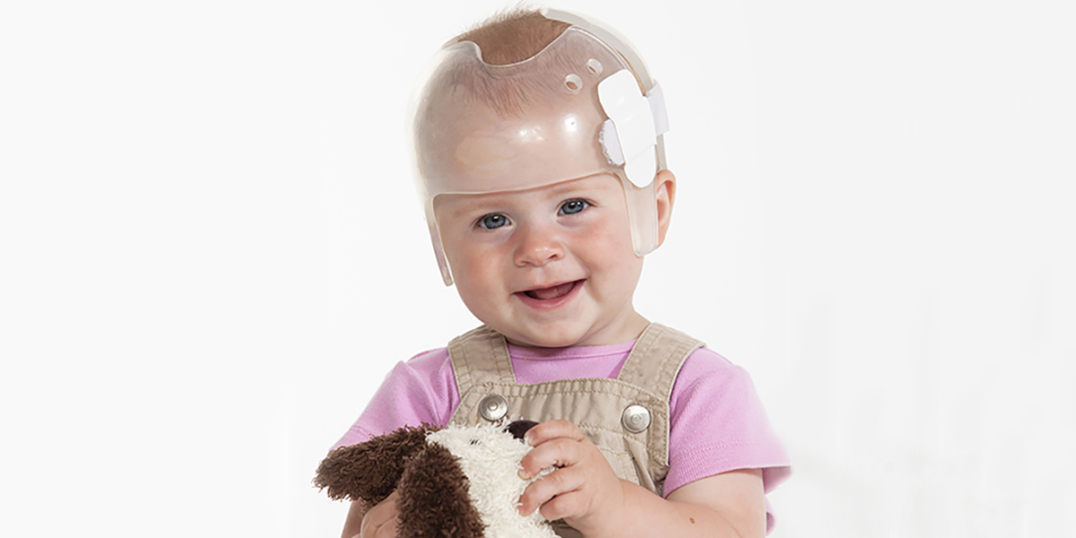 child with Craniofacial Syndromes