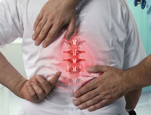 Doctor identifying spine pain