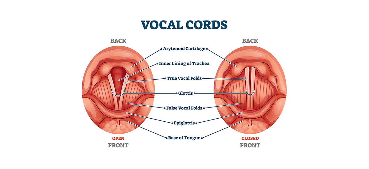 vocal cord stripping